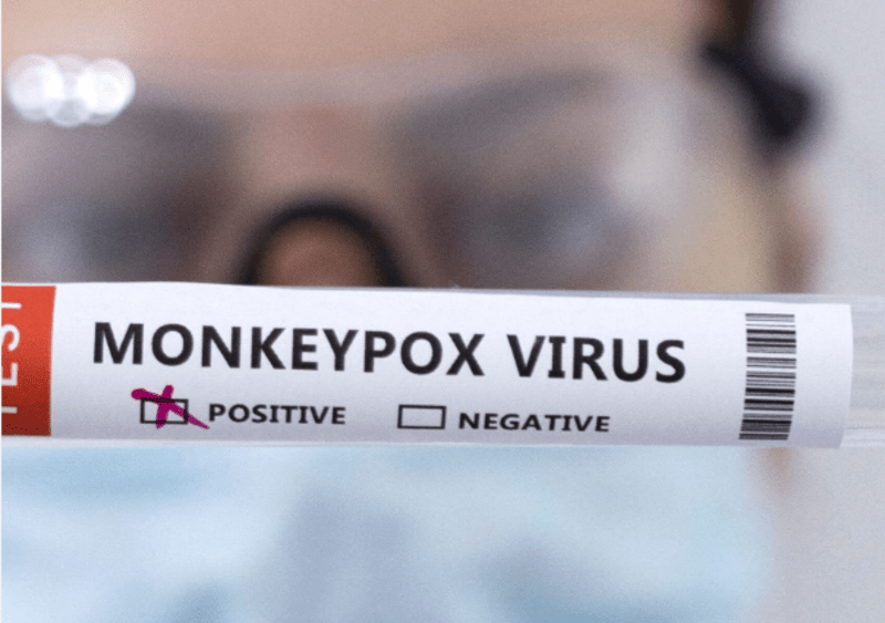 South Africa reports second monkeypox death this week
