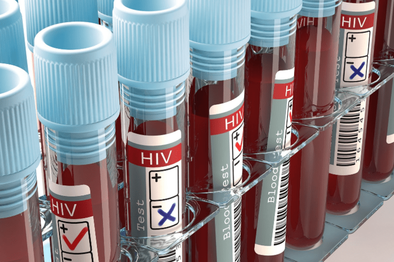 Kilifi County records significant drop in HIV prevalence
