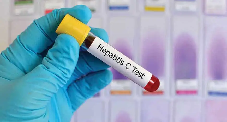 WHO unveils the first self-test for hepatitis C virus