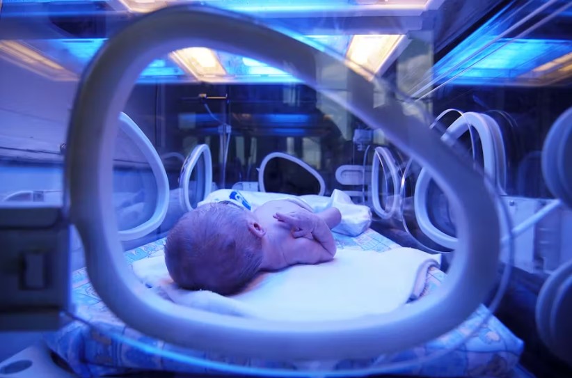 Understanding jaundice in newborns, its causes and treatment