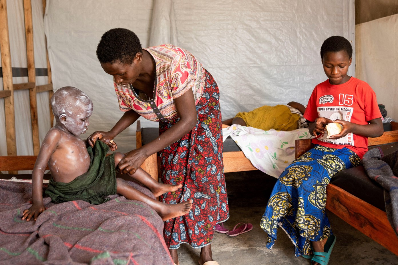 There is an mpox jab; why is it taking so long to reach Africa? - A woman applies medicine to the skin of her child, who is undergoing treatment for Mpox, an infectious disease caused by the Mpox virus that causes a painful rash, enlarged lymph nodes and fever, in Munigi, Nyiragongo territory, near Goma in North Kivu province of the Democratic Republic of Congo August 19, 2024. REUTERS