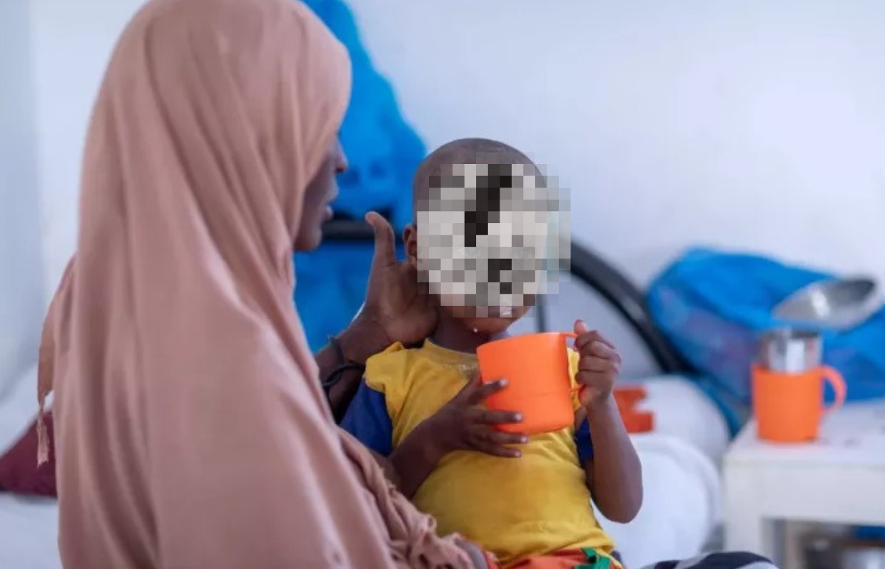 UNICEF reports extreme food deprivation among Somali children - A Somali woman feeding her baby. (Photo: UNICEF)