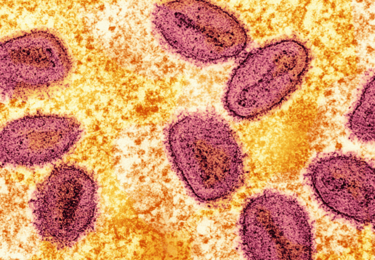 Uganda's mpox caseload rises to ten - official - An undated colorized transmission electron micrograph of mpox virus particles (pink) found within an infected cell (yellow), cultured in the laboratory, captured at the National Institute of Allergy and Infectious Diseases (NIAID) Integrated Research Facility (IRF) in Fort Detrick, Maryland. (Reuters)