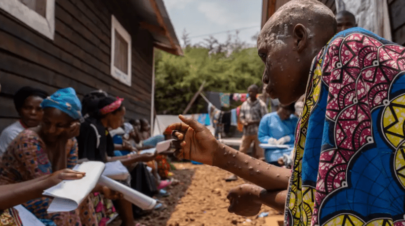 Congo: Displaced people caught between conflict and crisis