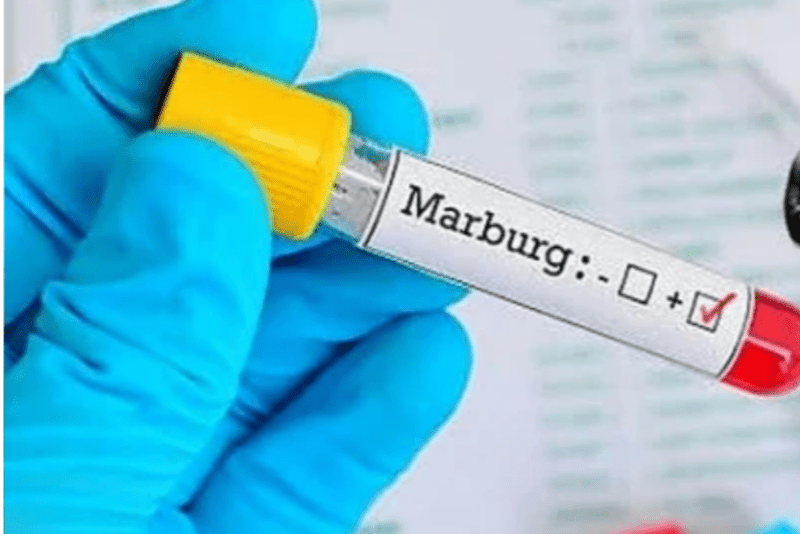 Ministry of Health warns public on Marburg Virus risks amid regional outbreak - A laboratory test tube with a sample that tested positive for Marburg virus.