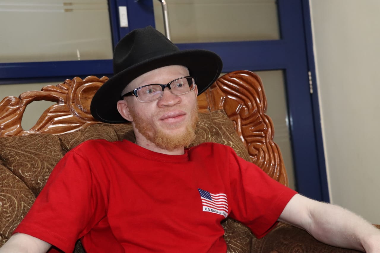 Meshack Wekesa rises from albinism stigma to inspiring change through music