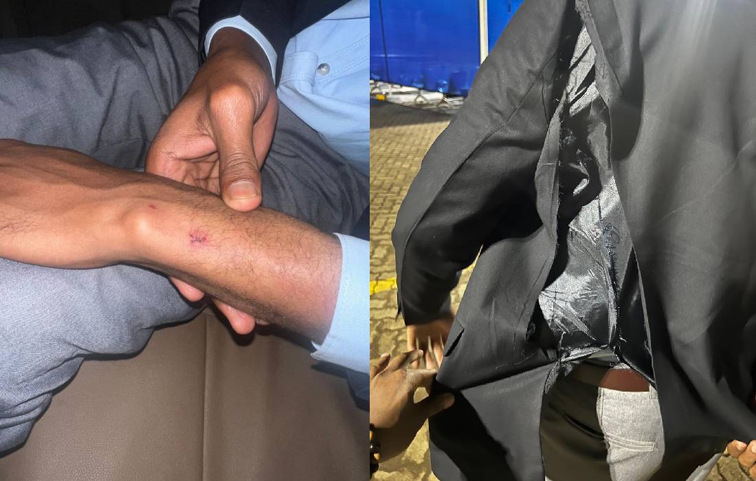 Eastleigh Voice journalist seeks justice after being assaulted by police outside BBS Mall