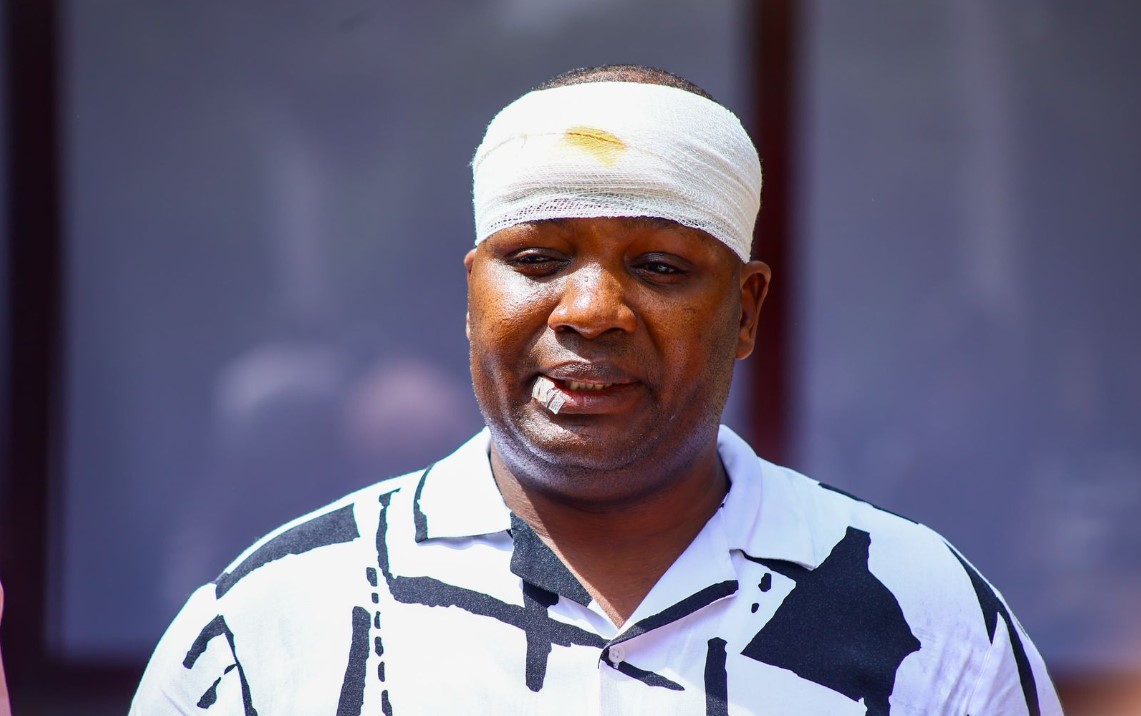 Nairobi MCAs vow to resist intimidation after 'attack' on Kitisuru legislator Alvin Palapala - Kitisuru MCA Alvin Palapala who was injured in an attack by goons on Kenyatta Avenue in Nairobi. (Photo: Maureen Kinyanjui)