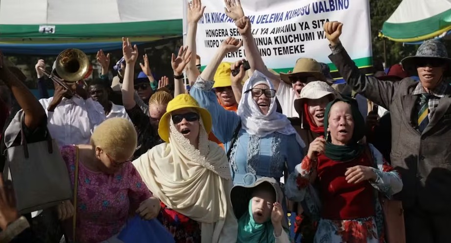 Attacks on people with albinism in Tanzania: African court holds government responsible – Why it matters - Tanzanians mark International Albinism Awareness Day in Dar es Salaam. (Photo: Herman Emmanuel/Xinhua via Getty Images)