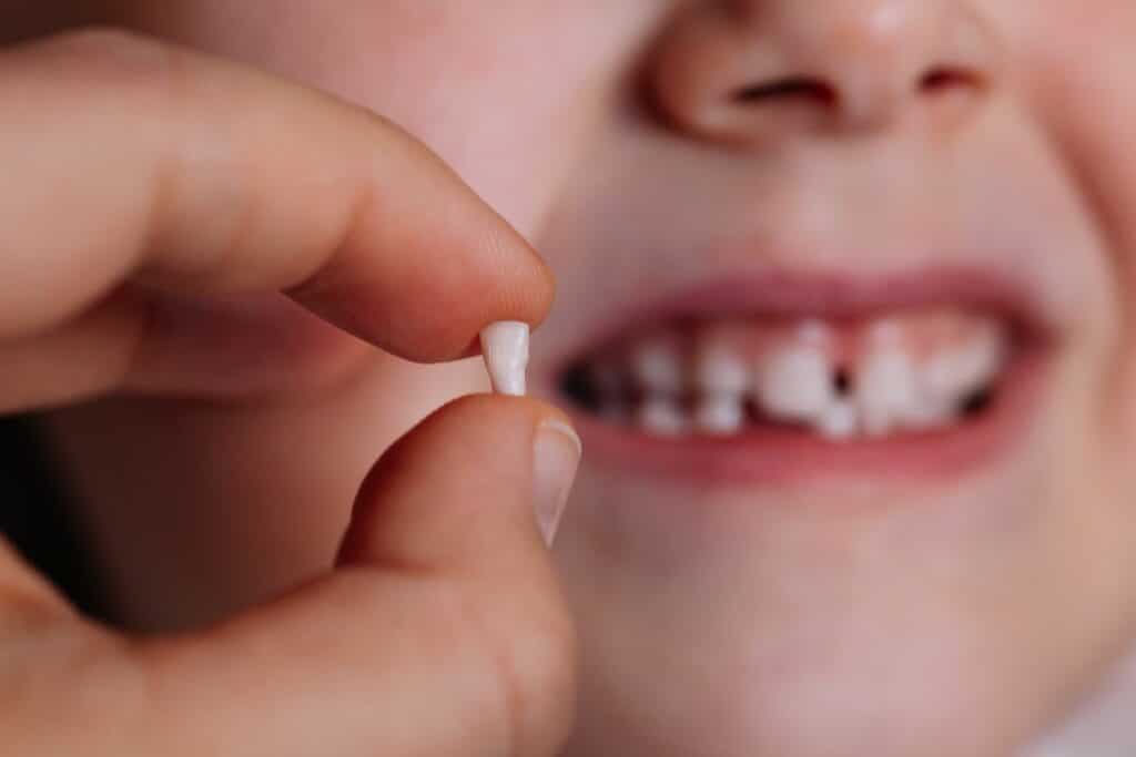 What really happens when your child swallows a tooth?