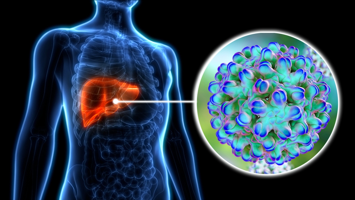 WHO flags Hepatitis D as carcinogenic, raises liver cancer alert