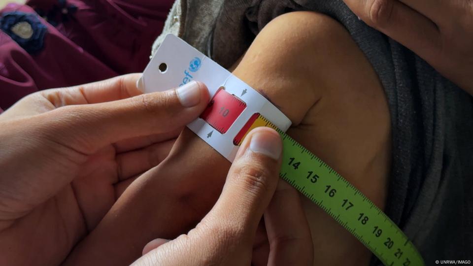 Italy to evacuate sick Palestinian children for medical treatment