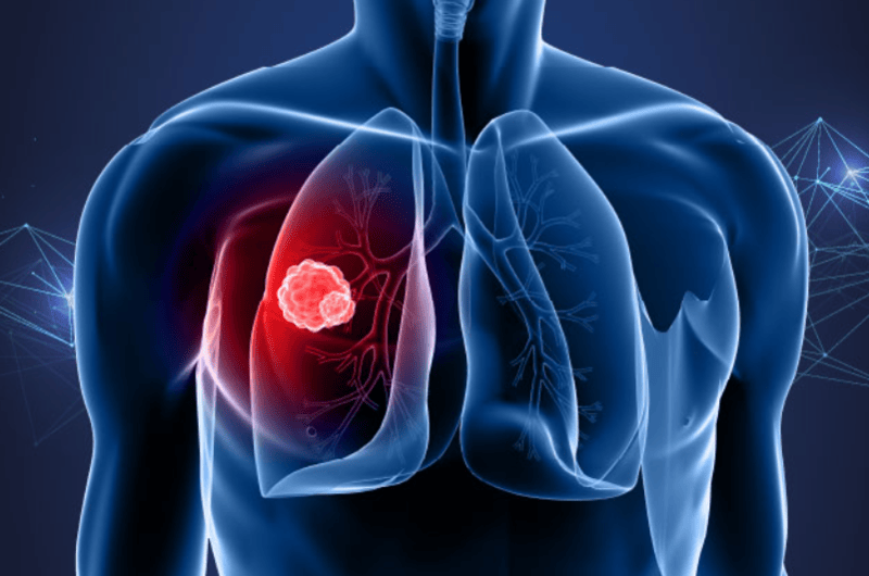 Liver cancer deaths set to double by 2050 as alcohol drives Kenya’s crisis