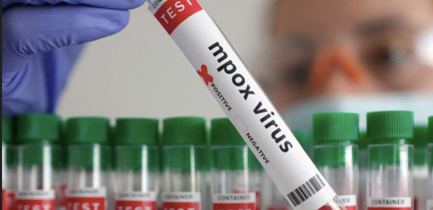 Namibia declares mpox outbreak after confirmed case in Swakopmund