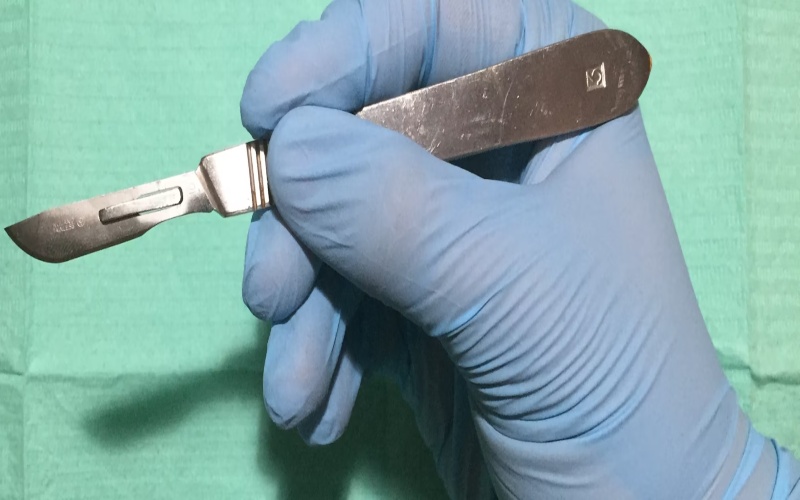 Male circumcision is made easier by a clever South African invention - we trained healthcare workers to use it