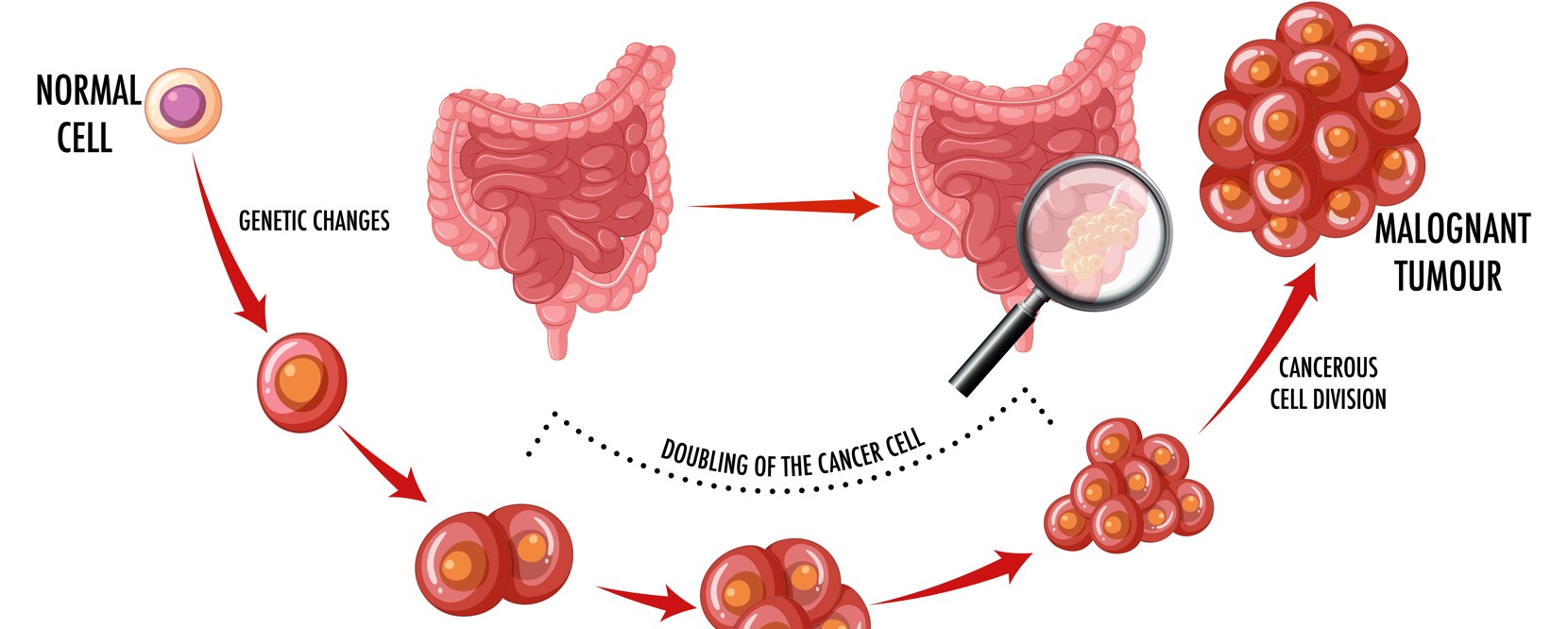 Once a disease of the elderly, colon cancer is now hitting people in their 30s and 40s
