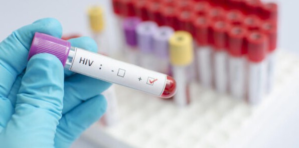 About 100,000 Kenyans out of 1.48 million living with HIV do not know their status - report