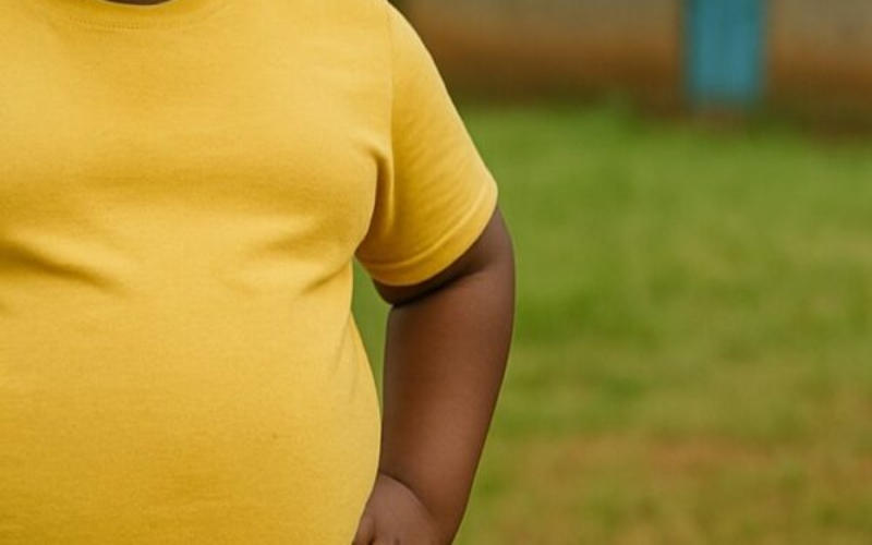 Explainer: How genetics shapes obesity and why environment still matters