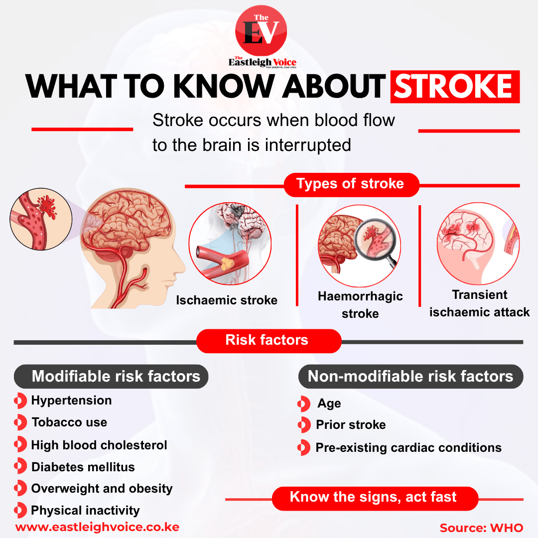 Stroke prevention: How key risk factors affect you