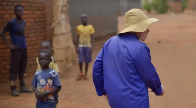 Report finds ongoing discrimination against people with albinism in Malawi