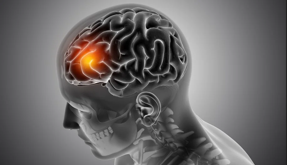 Scientists develop vitamin B12-based therapy that targets aggressive brain cancer