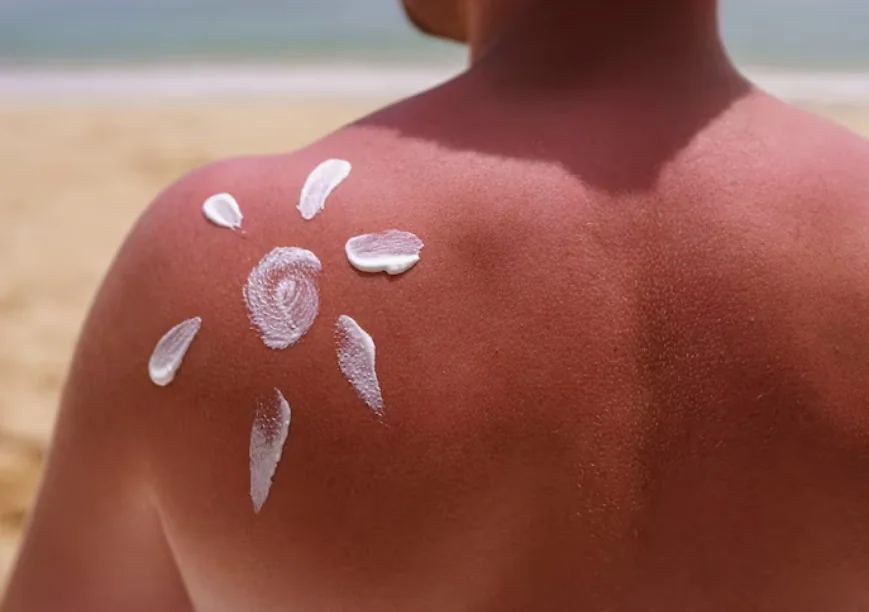 Why does sunscreen leave white cast on your skin- scientists may have found a solution
